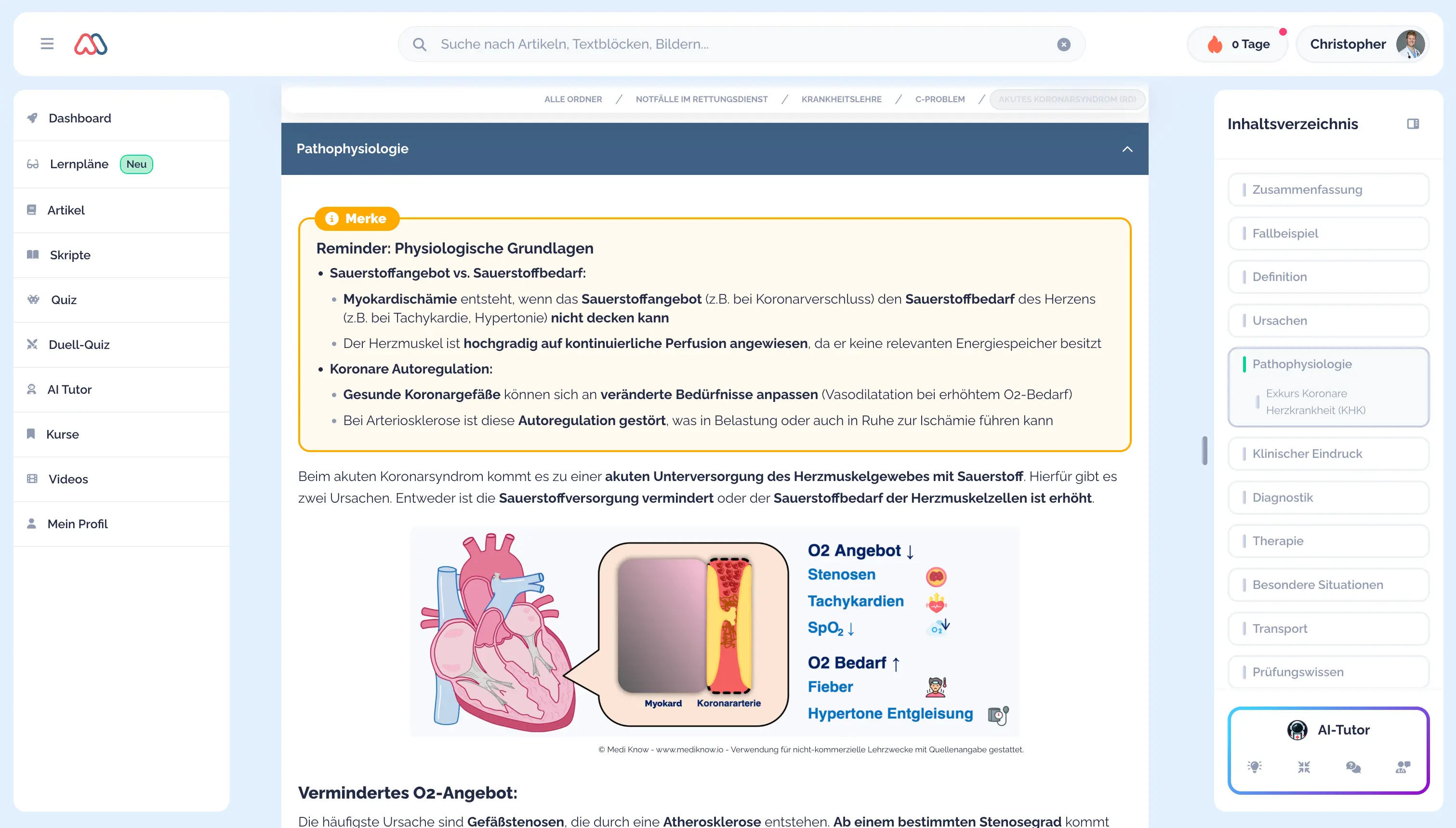Beispielartikel: Akutes Koronarsyndrom, Abschnitt Pathophysiologie mit Merkkasten und Abbildung