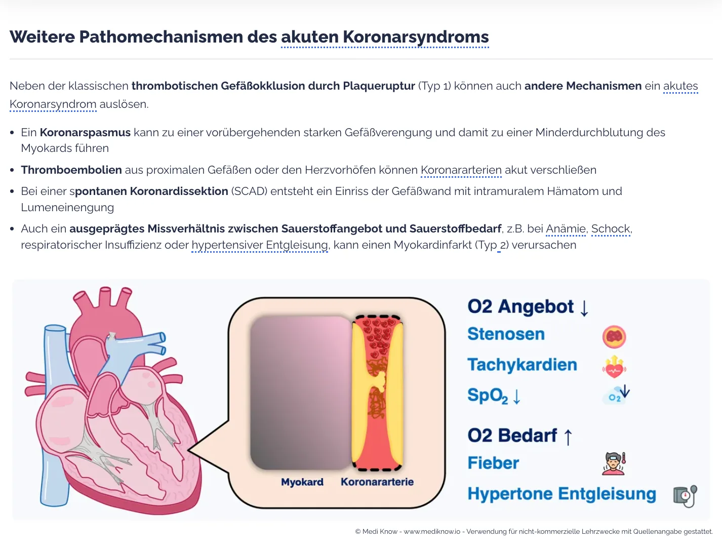 Lernartikel: Weitere Pathomechanismen des akuten Koronarsyndroms mit Herz-Illustration und O2-Angebot/Bedarf-Schema
